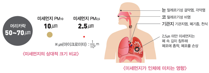 <미세먼지의 상대적 크기 비교 /> - 머리카락 50~70㎛, 미세먼지PM10 10㎛, 미세먼지 PM2.5 2.5㎛ (*㎛(마이크로미터):10의6제곱분의1 m) <미세먼지가 인체에 미치는 영향> - 눈 알레르기성 결막염 각막염, 코 알레르기성 비염, 기관지 기관지염 폐기종 천식 2.5㎛ 미만 미세먼지는 폐 속 깊이 침투해 폐포에 흡착, 폐포를 손상